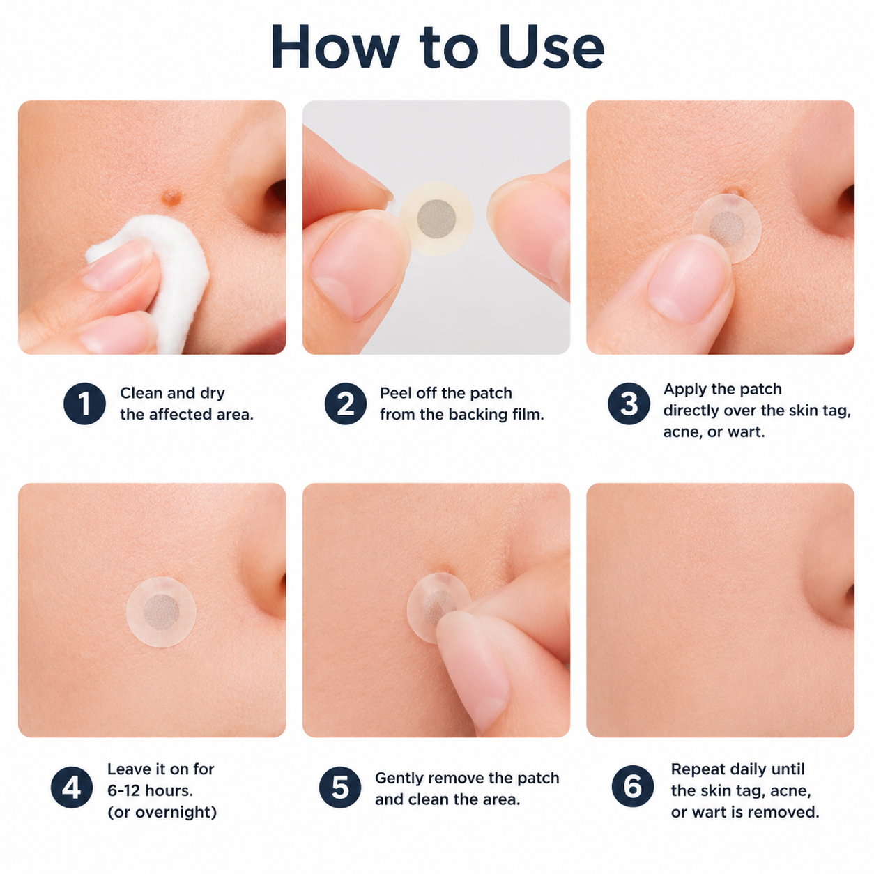 ✨Limited-Time Sale Ends Soon | Lumivo® 2-in-1 Microneedle Hydrocolloid Patches for Moles, Acne, Warts & Skin Tags